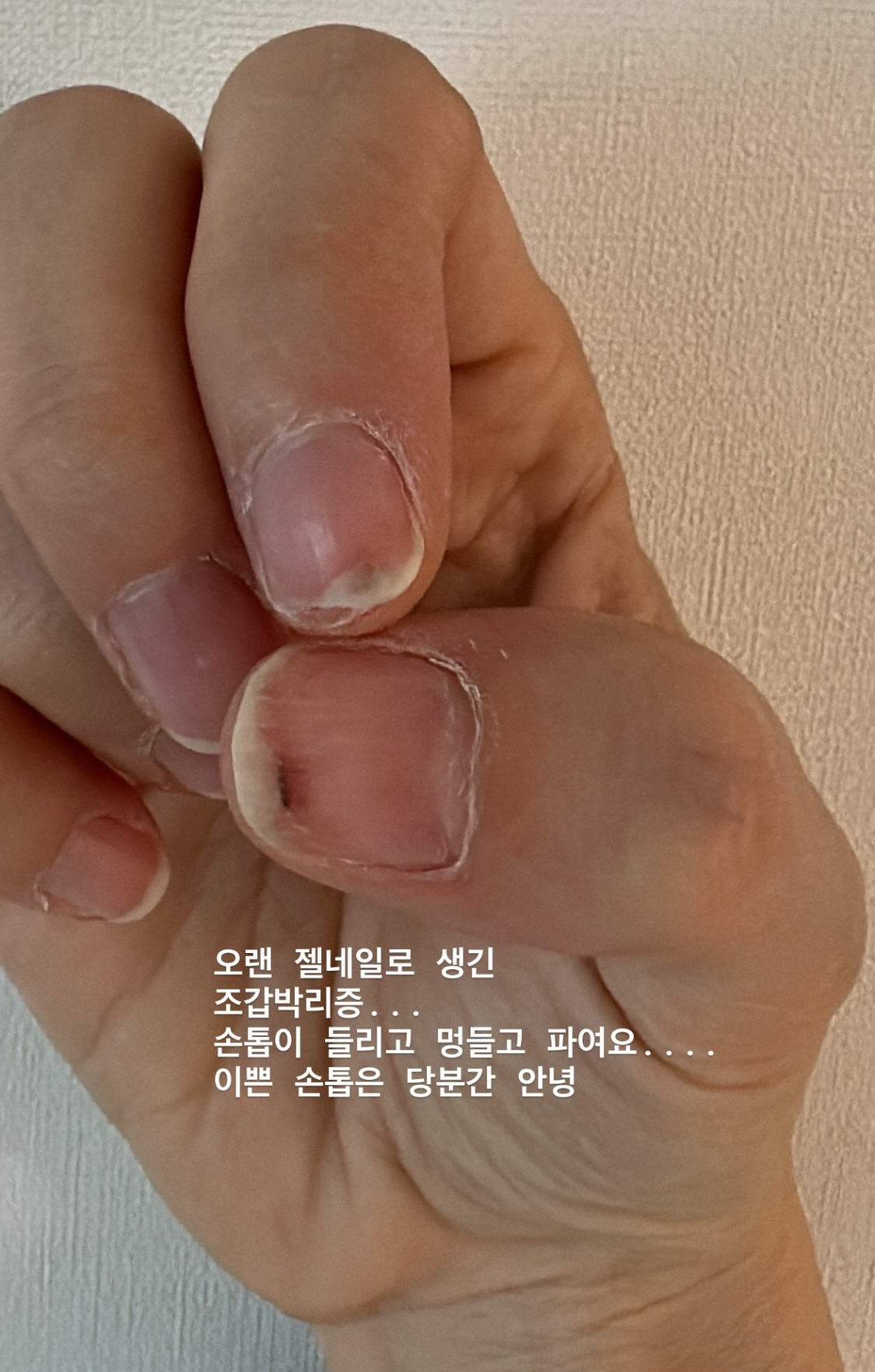 아이비 이미지