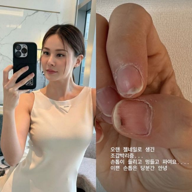 예쁜손톱 이미지