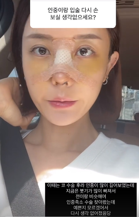 인중 이미지