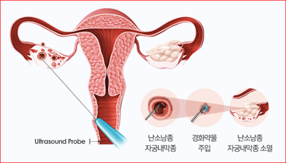 최상산부인과의원 이미지