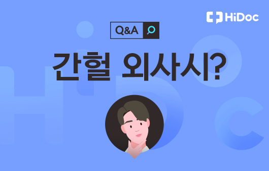 더 눈부심 이미지
