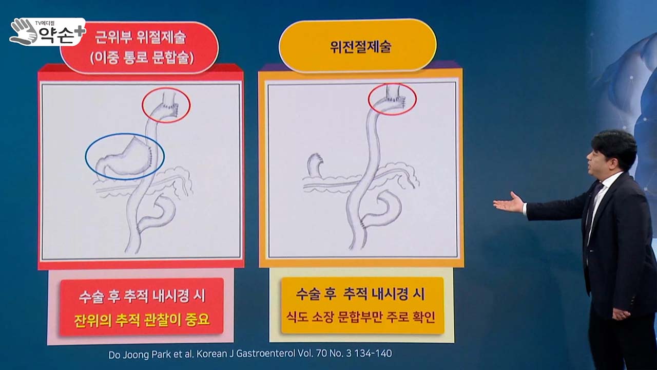 건강약손 이미지
