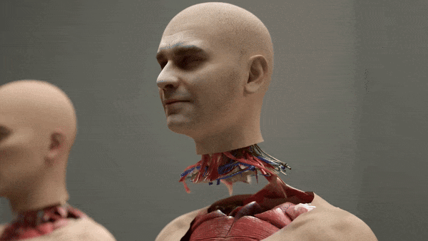 미국 스타트업 ‘브레인브릿지’(BrainBridge)가 지난달 22일 머리 이식술 그래픽 영상을 공개했다. (영상=Hashem Al-Ghaili 유튜브 캡처)