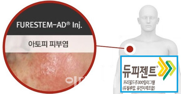 신흥에이디 이미지