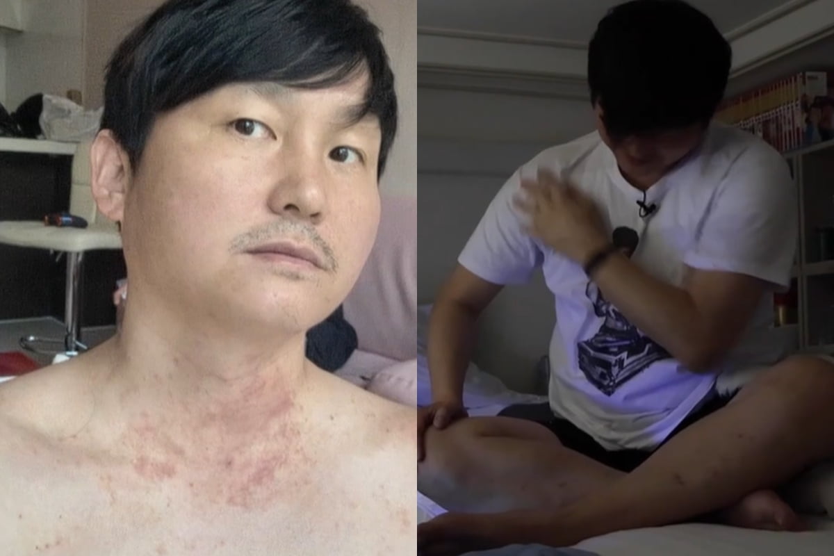 마빡이네 이미지