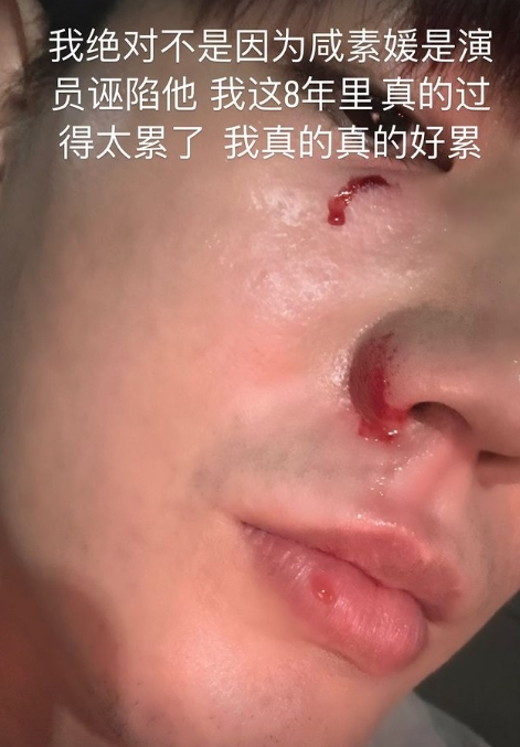 진화로 이미지