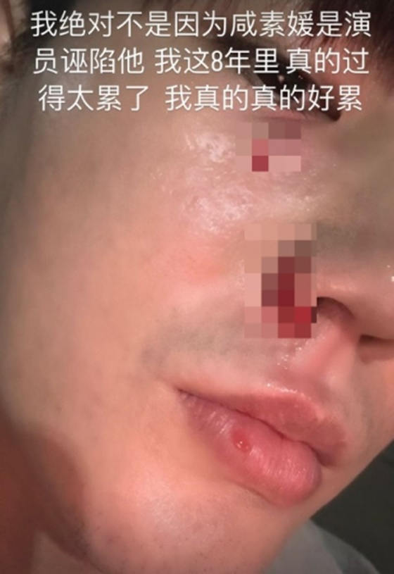 진화로 이미지