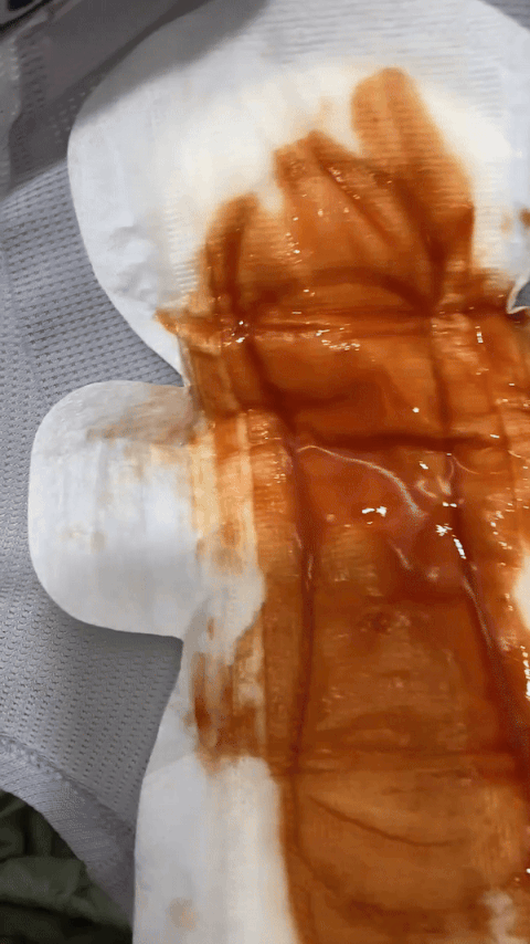 처음엔 생리대에 물을 묻혔다가, 실제 생리혈과 가급적 유사하게 만들기 위해 토마토 주스를 썼다. 그래도 계속해서 나오는 피덩어리와는 명백히 다르단 걸 잘 안다. 훨씬 더 꿉꿉하고 접촉할 때 힘들고 넘칠까봐 조마조마할 거란 걸./사진=남형도 기자