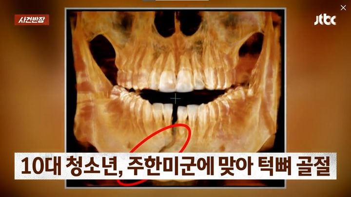 쳐다봐 이미지