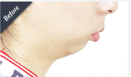 35bcd431e1d376a167b9f68b12d21a1d519fac69fc