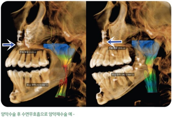 기능은 기본 미용은 그 다음