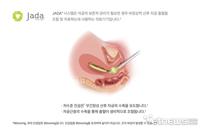 제이다 이미지