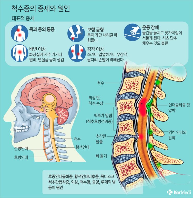 운동요법 이미지