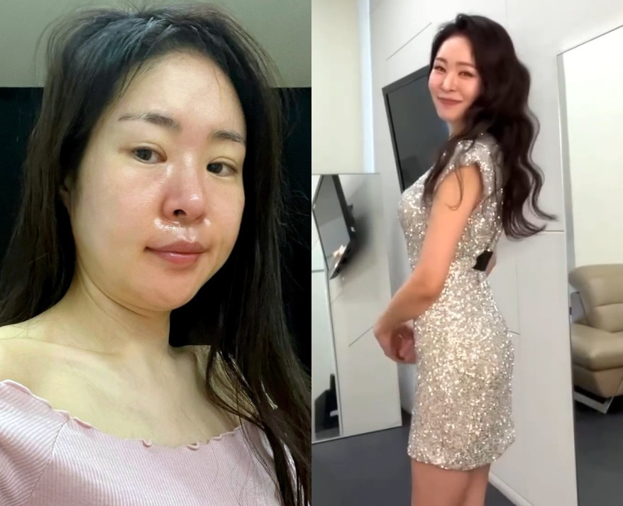 미자네 이미지