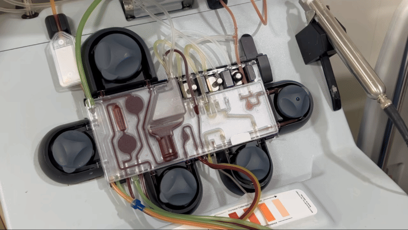 이씨 옆에 놓인 성분채집기. 원심분리기가 내장돼 있어 혈액에서 조혈모세포와 나머지 성분을 거르는 역할을 한다. /영상=민수정 기자.