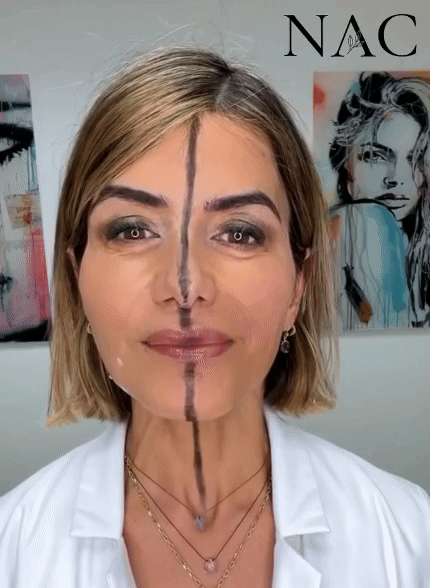 미국의 한 의사가 자신의 얼굴 한 쪽에만 보톡스를 주사해 충격을 주고 있다. 사진=뉴욕포스트