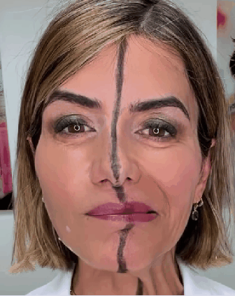 미국의 비타 패럴 박사가 보톡스를 맞은 오른쪽 얼굴(화면상 왼쪽)과 맞지 않은 왼쪽 얼굴을 비교해 설명하고 있다. [사진=비타 패럴 인스타그램 캡쳐]