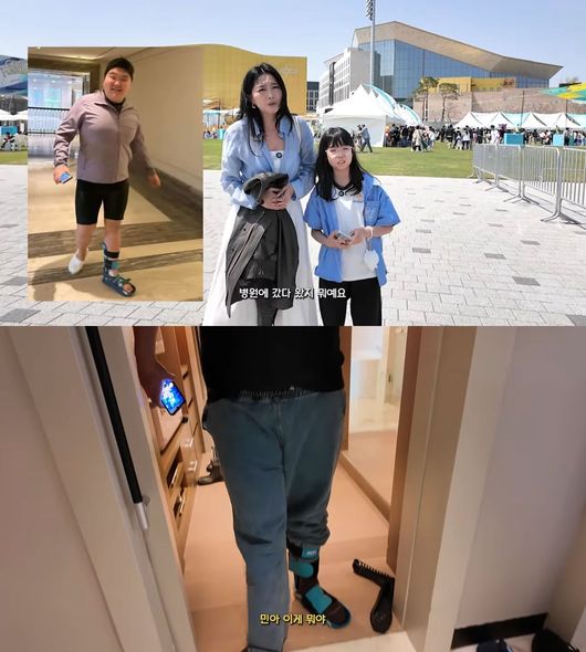 깁스 이미지