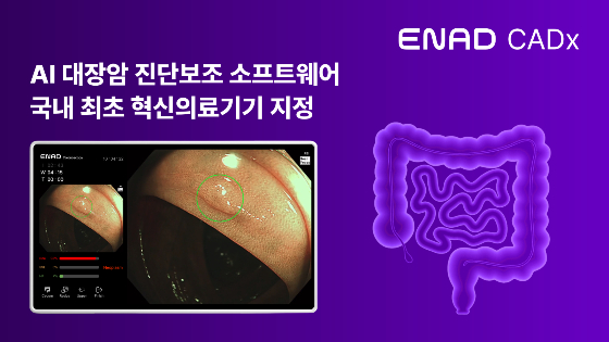 아이넥스 이미지