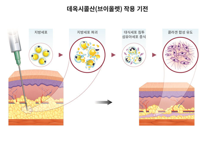 주로 이미지