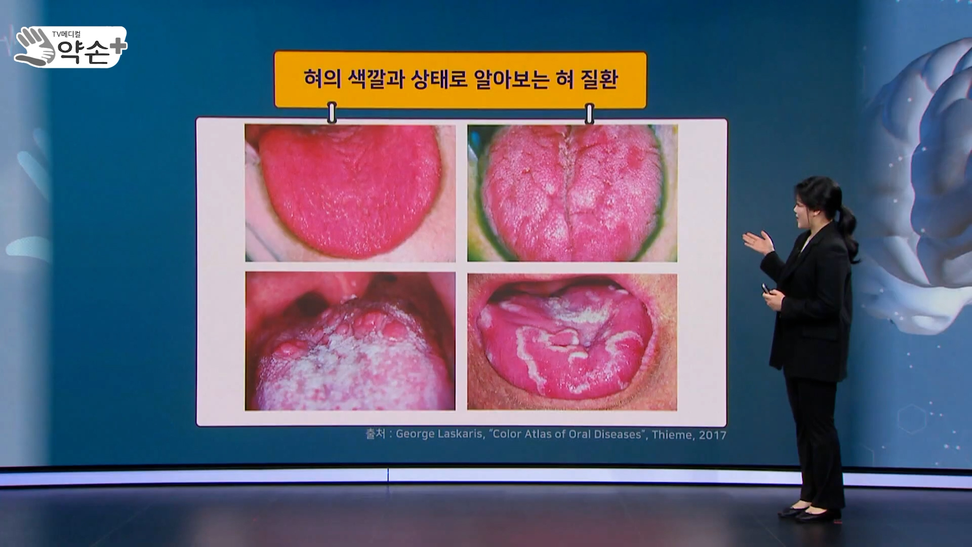 건강약손 이미지