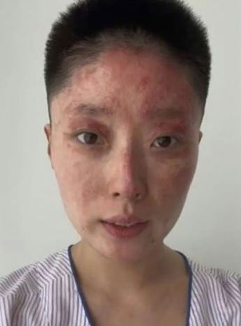 지우가스 이미지