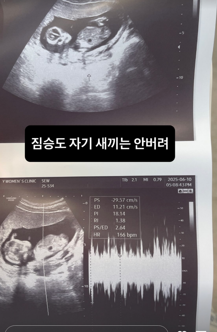 뉴스 이미지