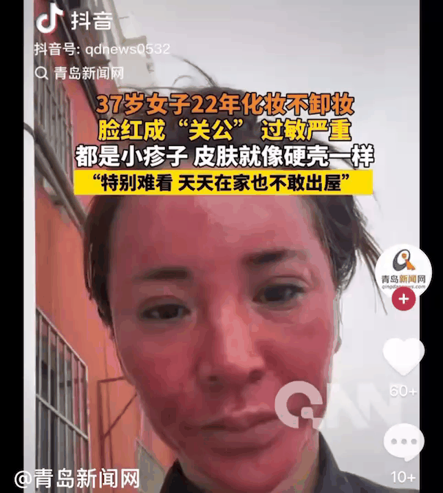 [서울=뉴시스]최근 중국 온라인 커뮤니티를 통해 22년간 화장을 제대로 지우지 않았다는 37세 여성 A씨의 사연이 전해지며 누리꾼들의 충격을 자아냈다.(사진=好看视频) *재판매 및 DB 금지