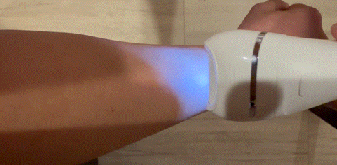 필립스 '샤티넬 어드밴스' 모근제거기로 팔을 제모하는 모습. ⓒ 뉴스1 김형준 기자