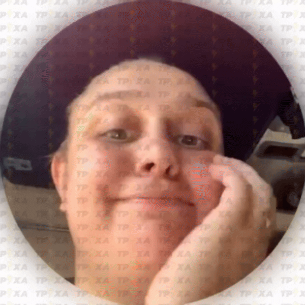 24일(현지시간) 러시아군의 탄도미사일 공격으로 드니프로페트로우스크주에서 최소 11명이 숨지고 160명이 다쳤으며, 사상자는 더 늘어날 수 있다고 볼로디미르 젤렌스키 우크라이나 대통령이 밝혔다. 사진은 이날 공격으로 다친 승객. 500명을 태우고 달리던 열차는 미사일 공격으로 파손됐는데 다행히 사망자는 나오지 않았다. 2025.6.24 텔레그램