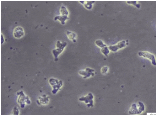 ‘뇌 먹는 아메바’로 알려진 파울러자유아메바(Naegleria fowleri). /미 CDC