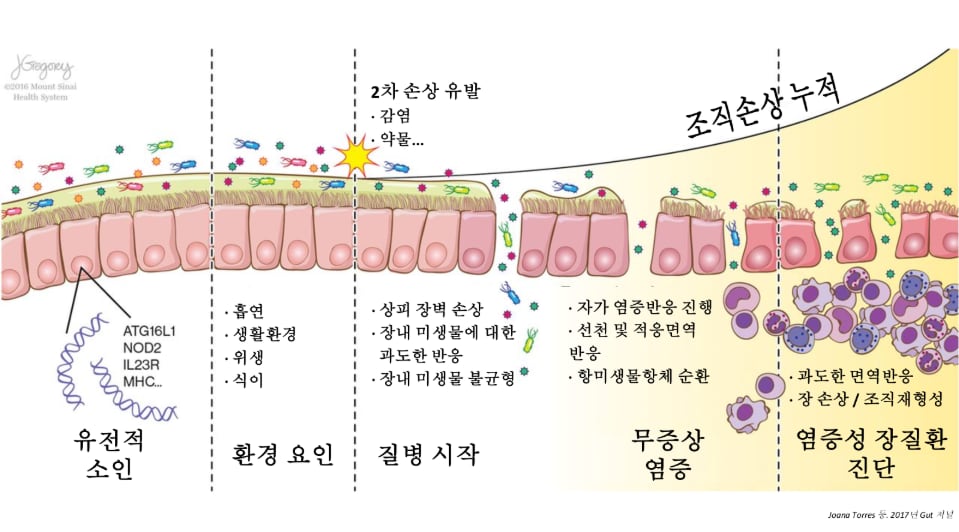 [명의를 찾아서] “청년 덮친 염증성 장 질환…정밀 진단, 맞춤 치료로 일상 지킨다”