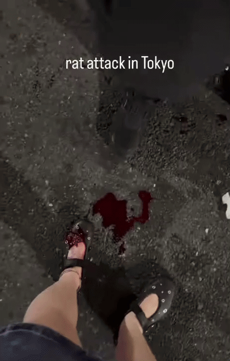 일본 도쿄 신주쿠 거리를 걷던 한 해외 관광객이 쥐에 물리는 사고를 당해 부상을 입었다. 인스타그램