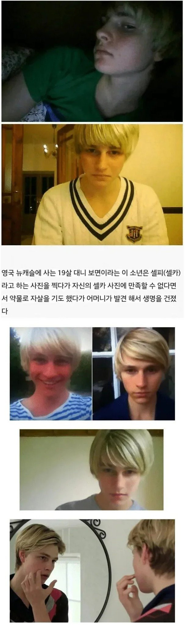 못생겨서 자살 시도한 청소년 | 인스티즈