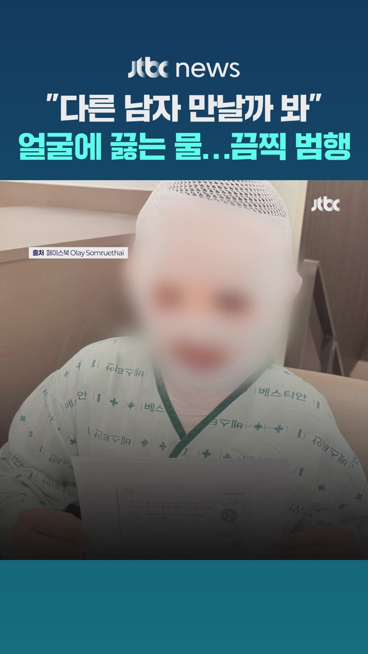 "못생기게 만들려고"…아내 얼굴에 '끓는 물' 부은 남편 - kakaoTV "못생기게 만들려고"…아내 얼굴에 '끓는 물' 부은 남편