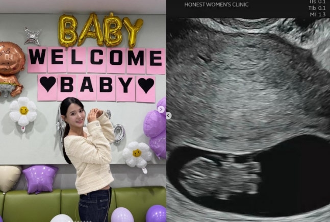 노란 수영복에 섹시한 몸매 어필하는 존예 처자