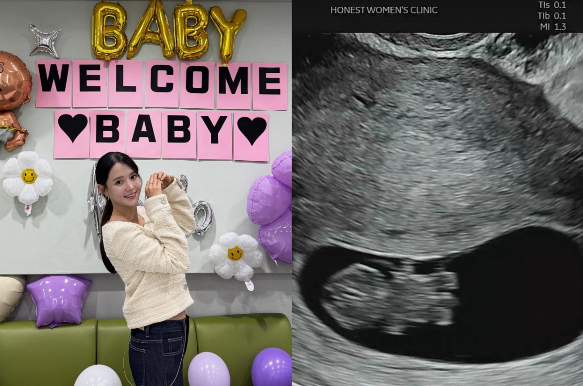 노란 수영복에 섹시한 몸매 어필하는 존예 처자