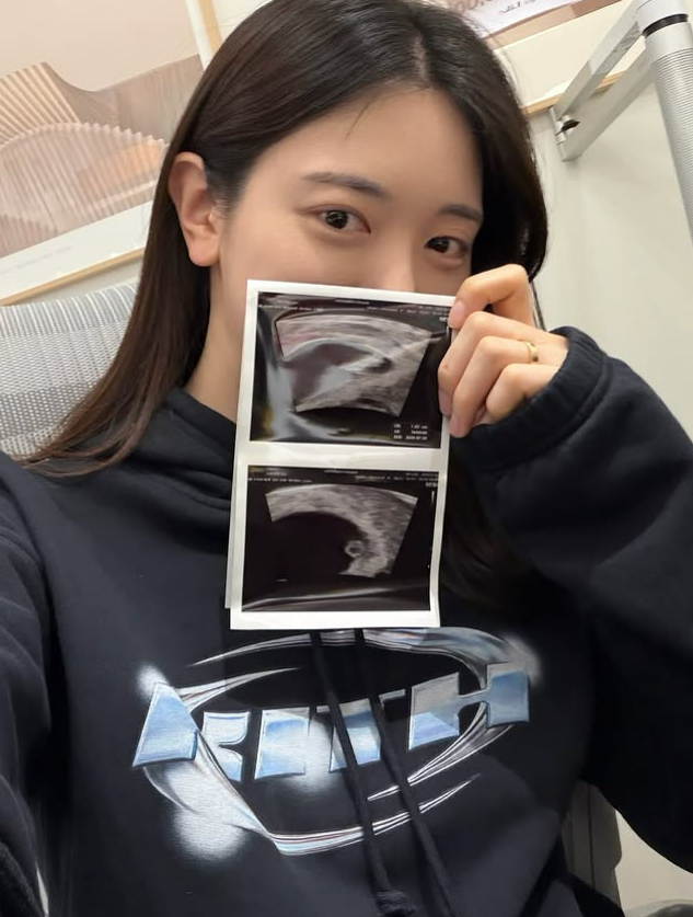 노란 수영복에 섹시한 몸매 어필하는 존예 처자