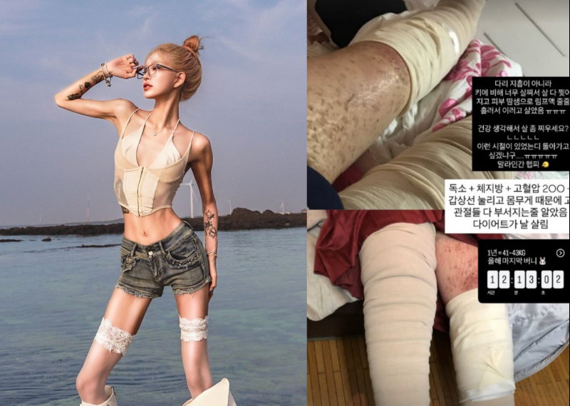 노란 수영복에 섹시한 몸매 어필하는 존예 처자