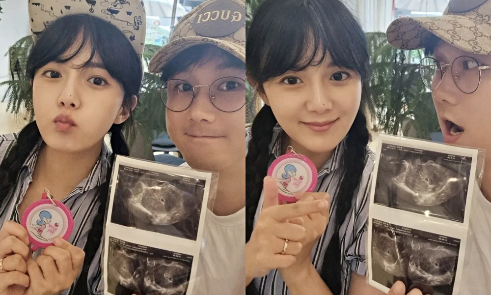 노란 수영복에 섹시한 몸매 어필하는 존예 처자