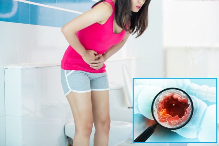 “매일 설사 수차례”...장 염증 오래가면, 왜 대장암 될까?