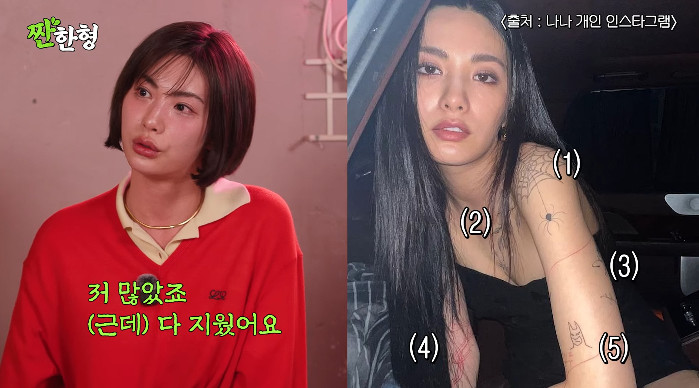 나나, 전신 타투 99% 사라졌다…