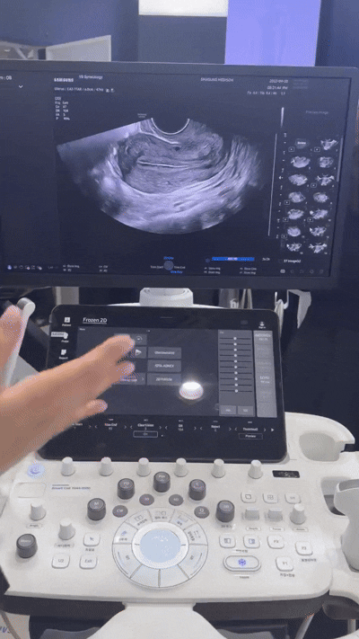 삼성메디슨 관계자가 초음파 기기를 시연하고 있다. [사진=황세웅 기자]