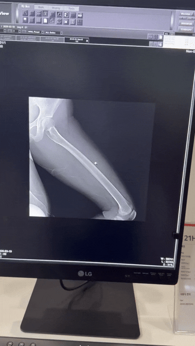 LG전자 진단용 디스플레이는 고해상도와 정밀한 색 표현을 기반으로 영상 판독 정확도를 높이는 데 초점을 맞췄다. [사진=황세웅 기자]