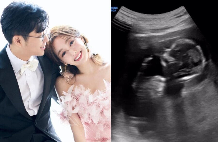 노란 수영복에 섹시한 몸매 어필하는 존예 처자