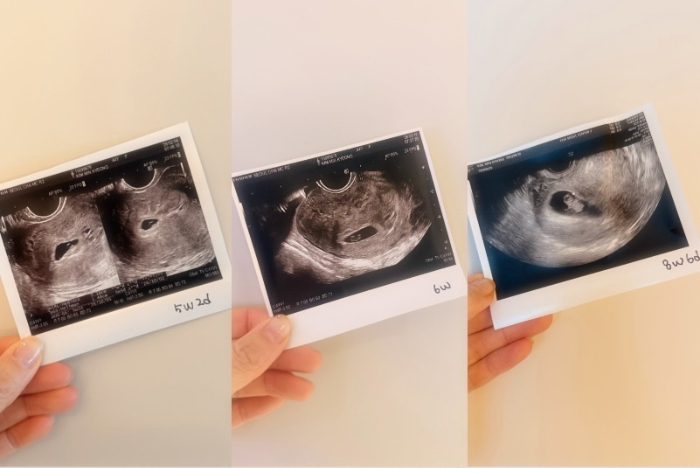 노란 수영복에 섹시한 몸매 어필하는 존예 처자