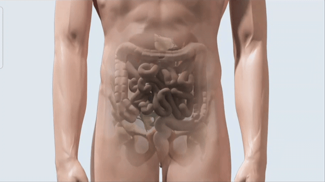 피해 이주노동자의 장 파열 위치는 맹장과는 정반대편입니다.