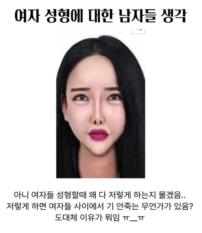 남자들은 은근 이해안된다는 여자 성형.jpg | 인스티즈