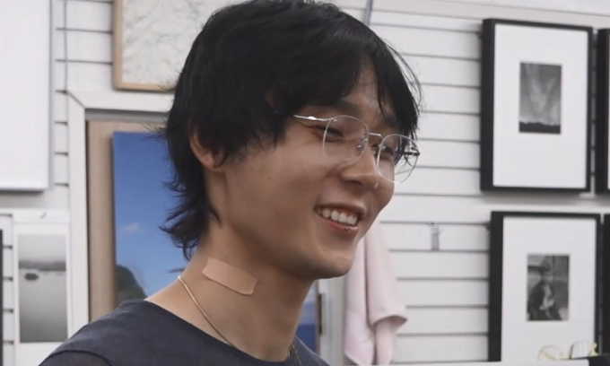만성부신증후군 증상 및 원인 던 나혼산