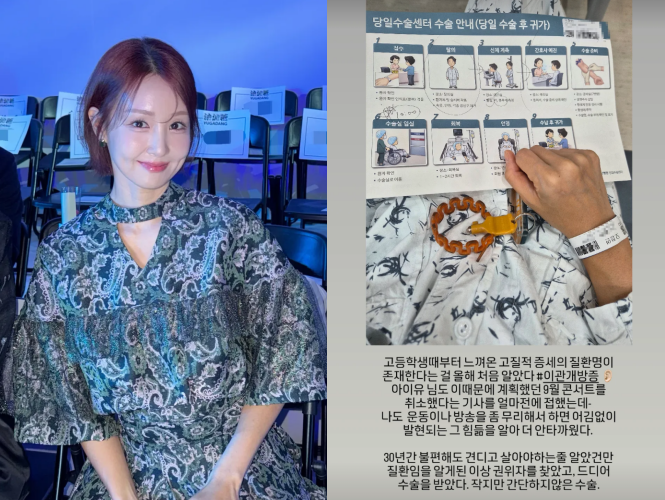 오정연 이관개방증 수술 고백